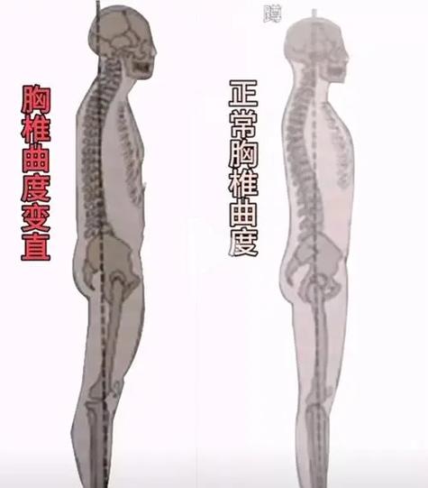 弯的男生会变直吗