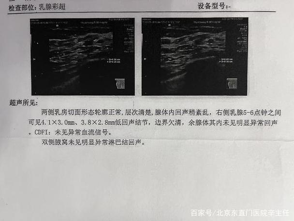 机顶盒个别台没有声音缩略图