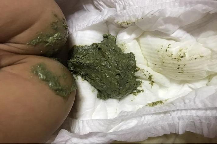 大便黑绿色正常吗图标