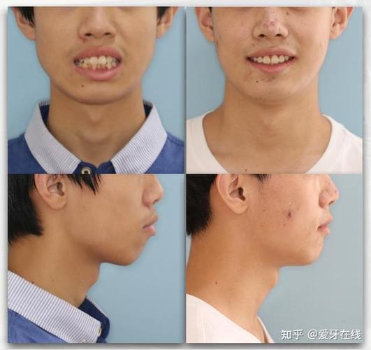 整牙齿矫正游戏截图