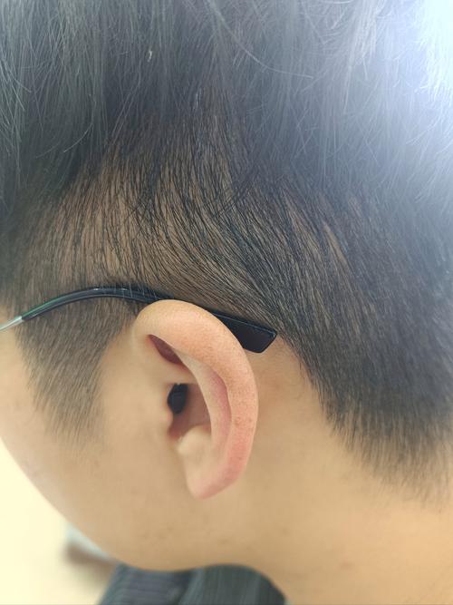 呼叫转移到另一个号码,另一个号会看缩略图