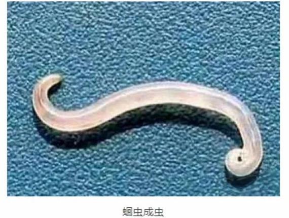 体内寄生虫手机下载