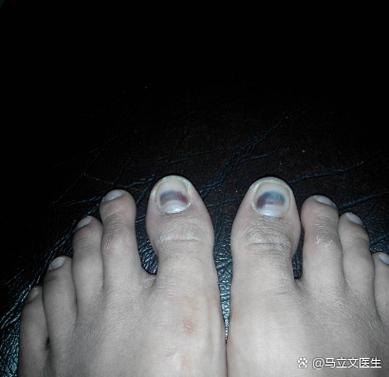 柚子肉里面有紫黑色的东西图标