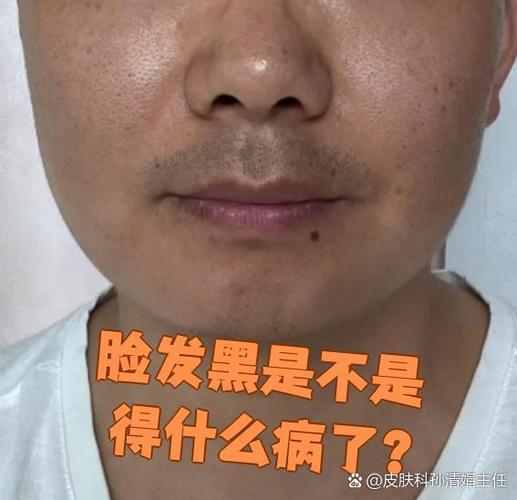 脸面发暗是怎么回事缩略图