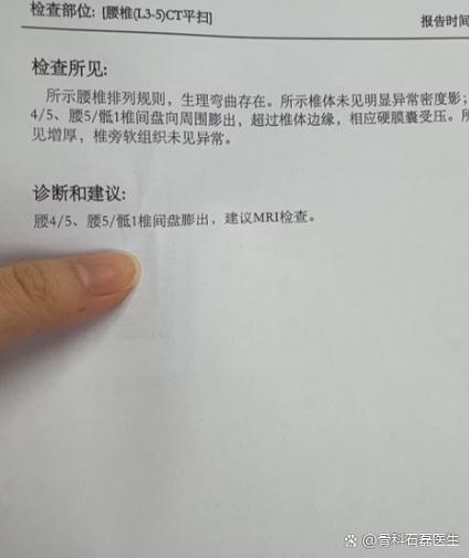 左边腰疼需要做哪些检查