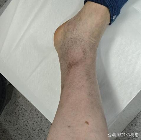沈阳下肢血管外科最好的医院排名图标