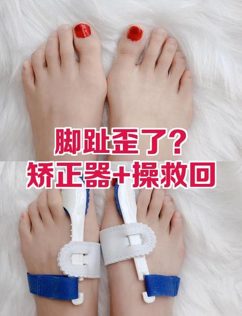 自行车脚踏摔弯了矫正器图标
