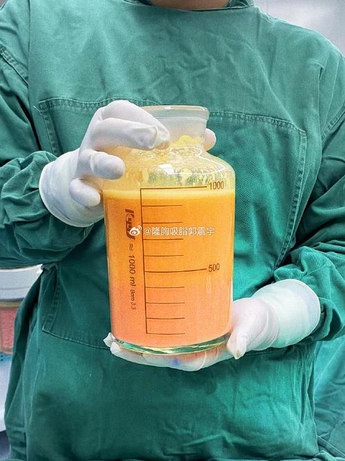 ceffe脂肪图标