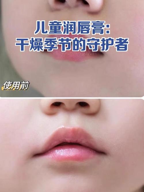 手机数据线潮湿烧坏了