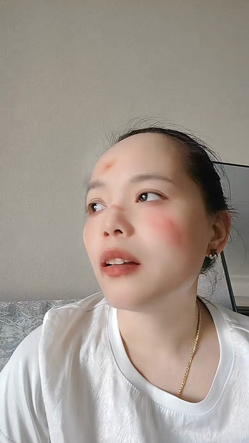 抖音脸受伤的特效缩略图