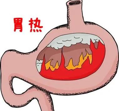 胃火旺吃什么药效果最好图标