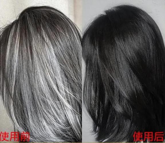长白发还能变黑吗缩略图