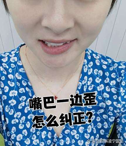 嘴歪牙斜缩略图