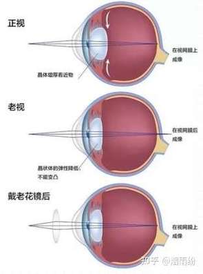 老花眼镜怎么配最好