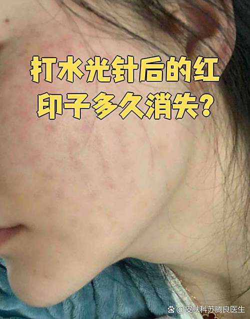 脸色发黑无光泽是怎么回事缩略图