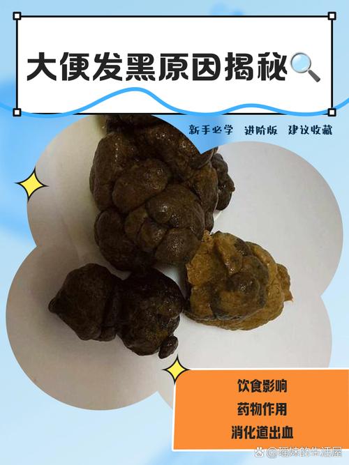 拉黑屎是什么原因缩略图