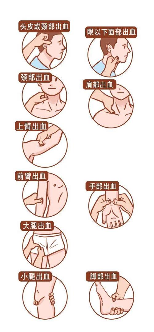流鼻血快速止住方法