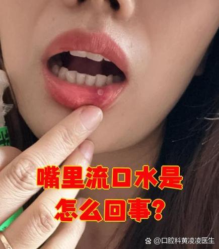 嘴巴里总感觉要掉口水图标