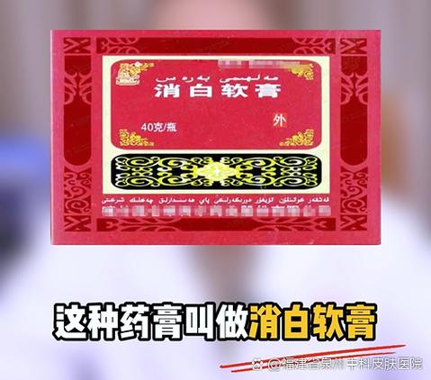 消白软膏一旦用了就不能停吗图标