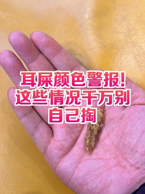 蓝牙耳机里面有耳屎怎么办游戏截图