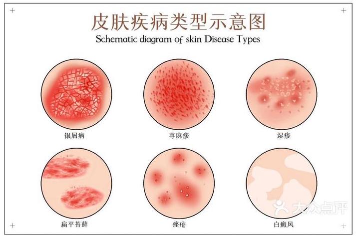图片看皮肤病缩略图