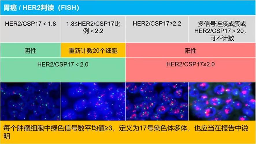 肿瘤fish检测是什么意思缩略图