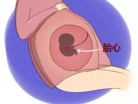 胎心能分辨出男孩女孩吗