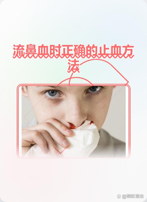 流鼻血最佳处理方法图标