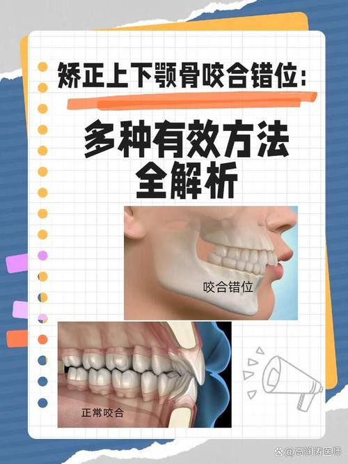 上下线不咬合怎么解决缩略图