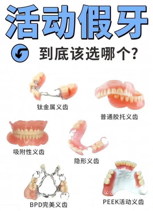 烤瓷牙和全瓷牙的区别哪个更好