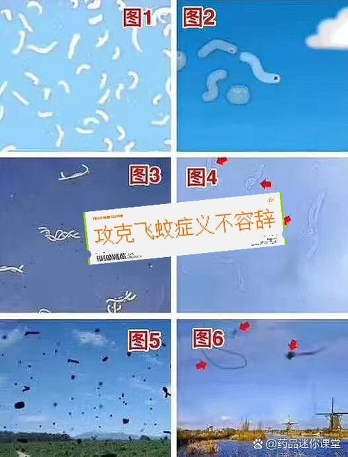 眼睛里的飞蚊症怎么消除