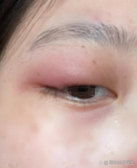 女人把眼睛哭肿了的说说缩略图