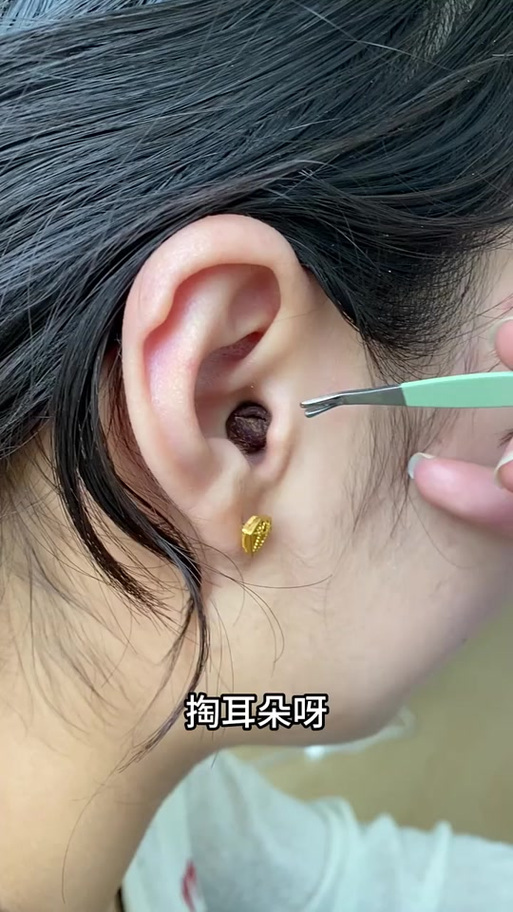 耳机有耳屎清理小妙招