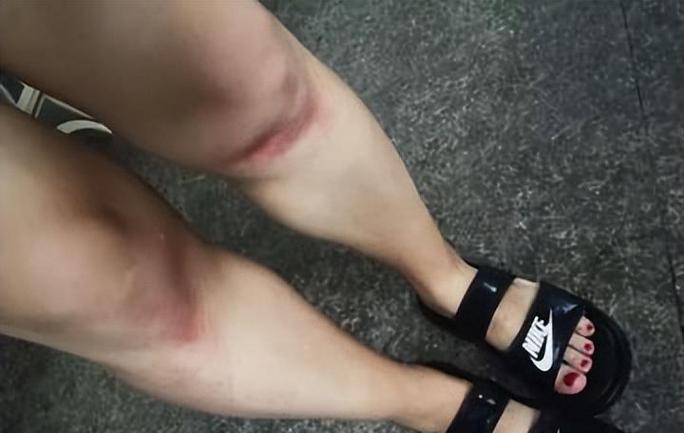 手慢慢下滑到大腿内侧要警惕四种病