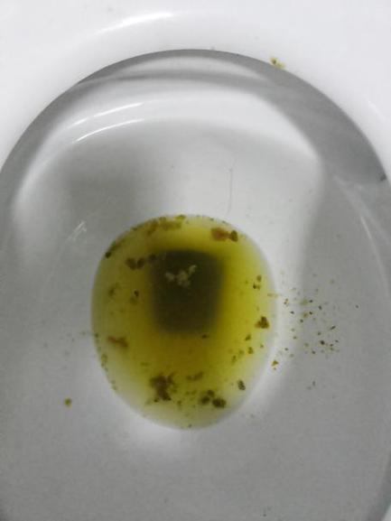 大便全是水