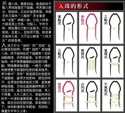 铁珠子吞了能拉出来吗