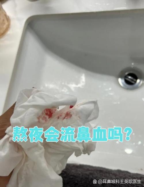 熬夜突然流鼻血是什么原因