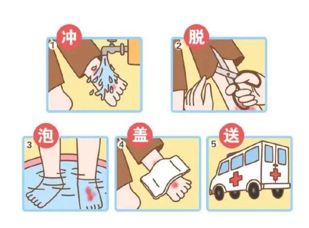 烫伤正确处理方法图标