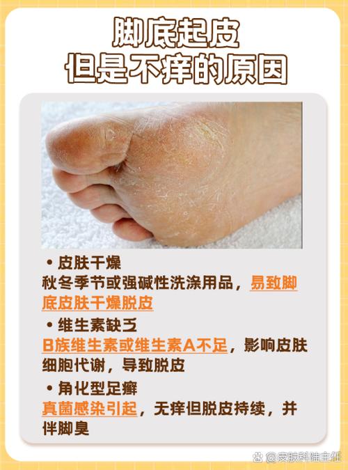 脚干燥开裂是什么原因引起的游戏截图