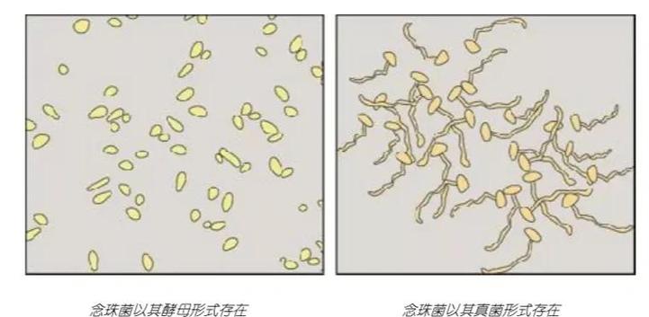 男性白色念珠菌感染图片