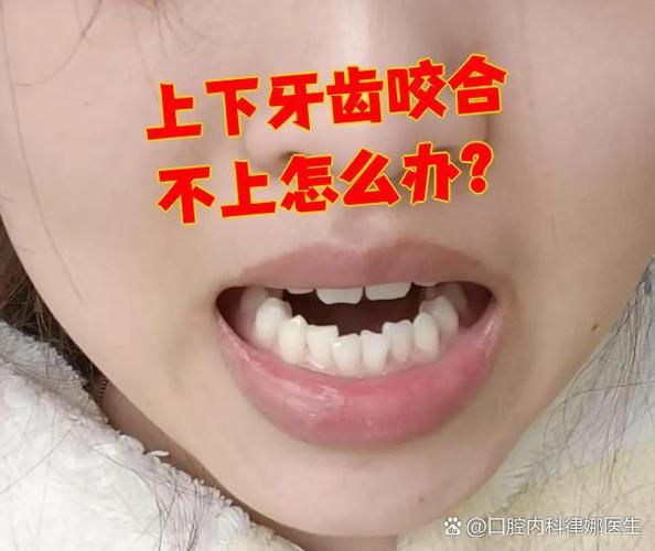 上下线不咬合怎么解决