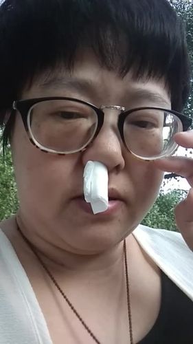 快手让男人流鼻血的视频缩略图