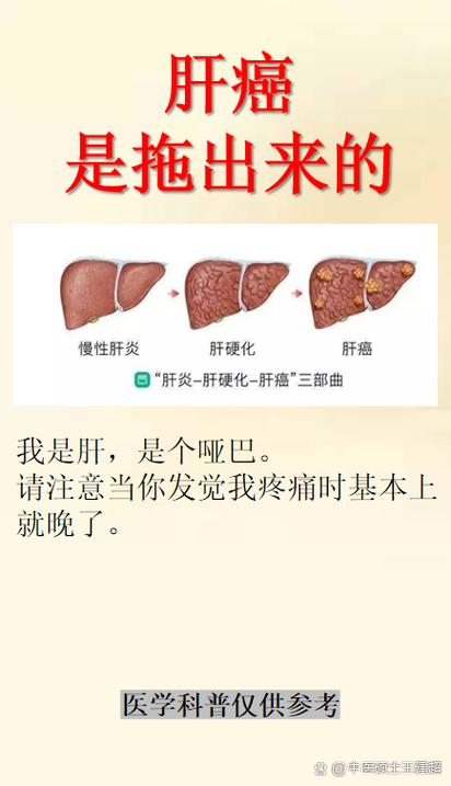 肝病最明显的一个征兆缩略图