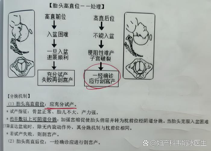胎儿超声hc是什么意思