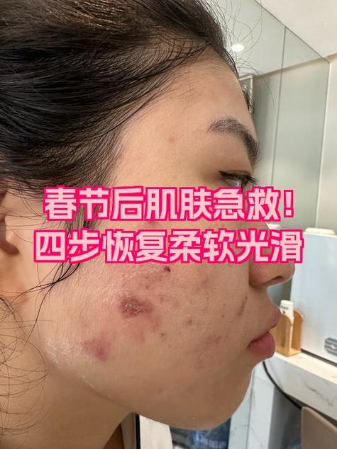 脸过敏发红发痒眼睛肿缩略图