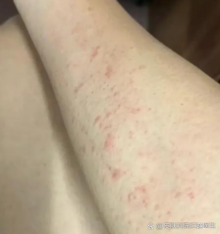 先是红点后变成褐色图标