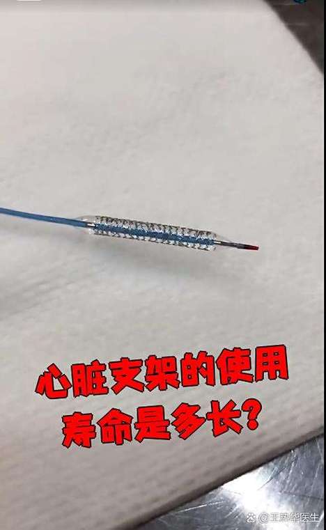 支架的寿命是多少年缩略图