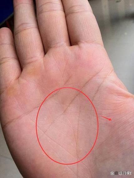 女人智慧线上有三角纹