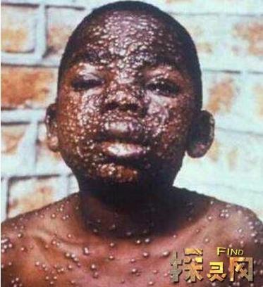 艾波拉病毒2电影完整版免费观看图标