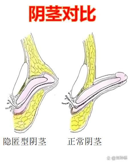 和平精英地图不显示脚步缩略图
